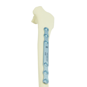Fracture Treatment