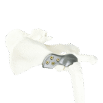 (USA) 3D HIP Workshop