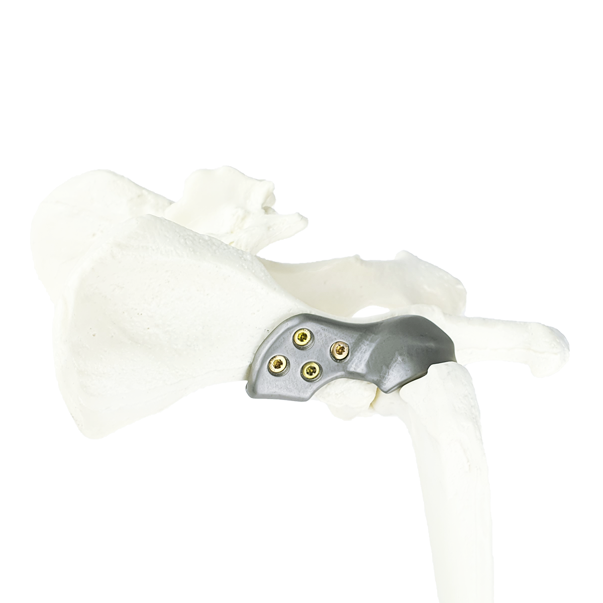 (USA) 3D HIP Workshop