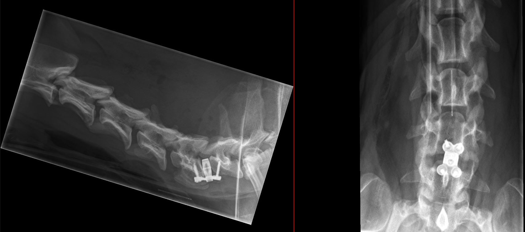Ashira C-Lox case