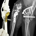 Advancements in Orthopedics - Headless Compression Screw Applications & TPLO with Patella Luxation Spacers