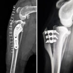 Behandlung von Kreuzbandrissen: Extrakapsuläre Verfahren und Osteotomien für Einsteiger